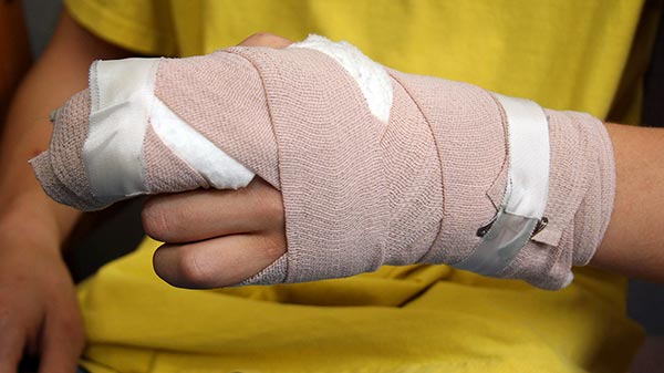 preventing hand injuries